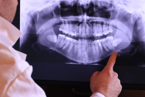 Best Emergency Treatment for Toothache in Lehi, UT